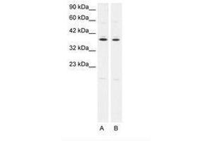 Image no. 1 for anti-Prostaglandin E Receptor 3 (Subtype EP3) (PTGER3) (C-Term) antibody (ABIN202406) (PTGER3 抗体  (C-Term))