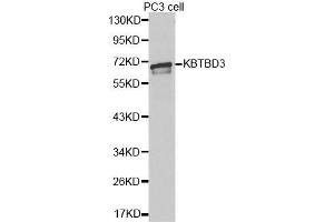 Western blot analysis of extracts of PC3 cell lines, using KBTBD3 antibody. (KBTBD3 抗体  (AA 410-607))