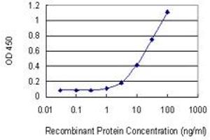 Detection limit for recombinant GST tagged LIMA1 is 0. (LIMA1 抗体  (AA 1-598))