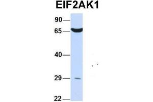 Host:  Rabbit  Target Name:  EIF2AK1  Sample Type:  Human 293T  Antibody Dilution:  1.