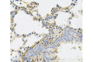 Immunohistochemistry of paraffin-embedded Rat lung using UBE2B Polyclonal Antibody at dilution of 1:100 (40x lens). (UBE2B 抗体)