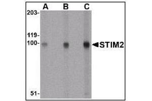Western blot analysis for AP22869PU-N of STIM2 in A-20 cell lysate with at (A) 0.