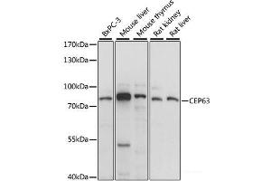 Western blot analysis of extracts of various cell lines using CEP63 Polyclonal Antibody at dilution of 1:1000. (CEP63 抗体)