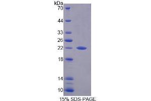 SDS-PAGE analysis of Human PFDN2 Protein. (PFDN2 蛋白)