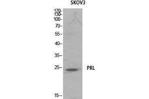 Western Blot (WB) analysis of SKOV3 cells using Prolactin Polyclonal Antibody. (Prolactin 抗体  (Internal Region))