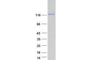 Western Blotting (WB) image for Leucine-Rich Repeats and Immunoglobulin-Like Domains 1 (Lrig1) protein (Myc-DYKDDDDK Tag) (ABIN2724889)