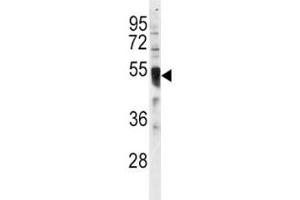 Western blot analysis of IRF8 antibody and HL-60 lysate. (IRF8 抗体  (AA 384-409))