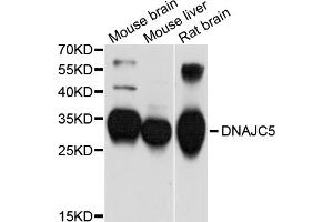 Western blot analysis of extracts of various cell lines, using DNAJC5 antibody (ABIN5997602) at 1/1000 dilution. (DNAJC5 抗体)