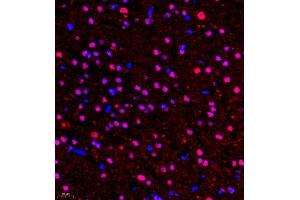 Immunofluorescence of paraffin embedded rat brain using HOXC9 (ABIN7074251) at dilution of 1:650 (400x lens) (HOXC9 抗体)