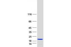 Validation with Western Blot (Stathmin 1 Protein (STMN1) (Transcript Variant 2) (Myc-DYKDDDDK Tag))