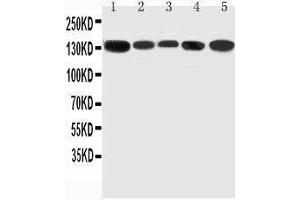 Anti-RGS3 antibody, Western blotting Lane 1: Rat Testis Tissue Lysate Lane 2: Rat Brain Tissue Lysate Lane 3: Rat Spleen Tissue Lysate Lane 4: HELA Cell Lysate Lane 5: U87 Cell Lysate