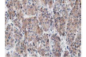 Image no. 6 for anti-Leucine Carboxyl Methyltransferase 1 (LCMT1) antibody (ABIN1499107) (LCMT1 抗体)