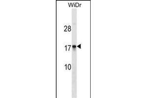 CDRT4 Antibody (Center) (ABIN1538462 and ABIN2849822) western blot analysis in WiDr cell line lysates (35 μg/lane). (CDRT4 抗体  (AA 50-79))