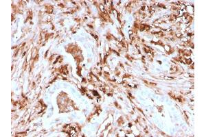 Formalin-fixed, paraffin-embedded human Pancreas stained with Ferritin, Light Chain Recombinant Mouse Monoclonal Antibody (rFTL/1388). (Recombinant FTL 抗体  (AA 38-165))