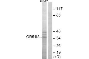 Western Blotting (WB) image for anti-Olfactory Receptor, Family 51, Subfamily I, Member 2 (OR51I2) (Internal Region) antibody (ABIN1853130) (OR51I2 抗体  (Internal Region))