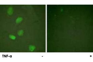 Immunofluorescence analysis of HeLa cells, treated with TNF-a (20 nM, 15 mins), using HDAC3 polyclonal antibody . (HDAC3 抗体)