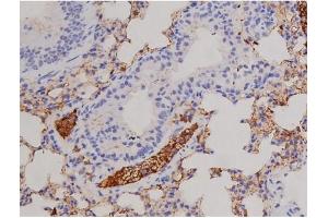 ABIN6267606 at 1/200 staining Mouse lung tissue sections by IHC-P. (FAK 抗体  (pTyr576))