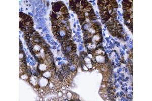 IHC analysis of NKCC1/SLC12A2 using anti-NKCC1/SLC12A2 antibody (ABIN7602601).