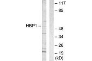 Western blot analysis of extracts from COS7 cells, using HBP1 Antibody. (HBP1 抗体  (AA 431-480))