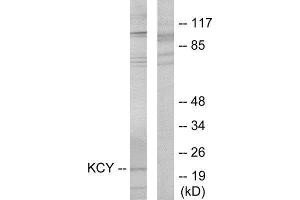 Western Blotting (WB) image for anti-KCY (N-Term) antibody (ABIN1849302) (KCY (N-Term) 抗体)