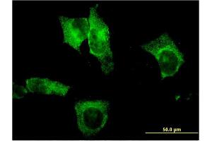 Immunofluorescence of monoclonal antibody to CEL on HeLa cell. (Cholesterol Esterase 抗体  (AA 378-477))