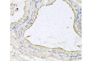 Immunohistochemistry of paraffin-embedded Human prostate using HPR Polyclonal Antibody at dilution of 1:100 (40x lens). (HPR 抗体)
