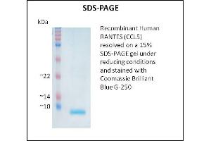 SDS-PAGE (SDS) image for Chemokine (C-C Motif) Ligand 5 (CCL5) (Active) protein (ABIN5509383) (CCL5 蛋白)