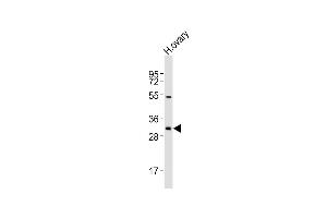 Anti-NBPF12 Antibody (Center)at 1:2000 dilution + human ovary lysates Lysates/proteins at 20 μg per lane. (NBPF12 抗体  (AA 148-181))