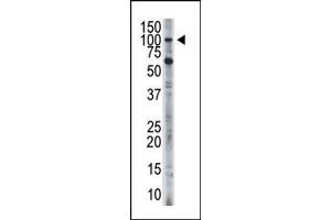Image no. 1 for anti-Hexokinase 3 (White Cell) (HK3) (C-Term) antibody (ABIN360637) (HK3 抗体  (C-Term))
