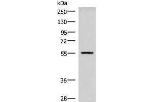 Western blot analysis of Human cerebella tissue lysate using CAMKK1 Polyclonal Antibody at dilution of 1:700 (CAMKK1 抗体)