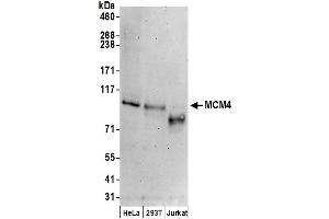 Western Blotting (WB) image for anti-Minichromosome Maintenance Deficient 4 (MCM4) (AA 325-375) antibody (ABIN7449391)