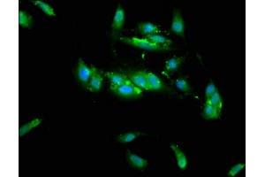 Immunofluorescence staining of Hela cells with ABIN7173439 at 1:133, counter-stained with DAPI. (TRIM35 抗体  (AA 1-206))