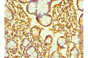 Immunohistochemistry of paraffin-embedded human small intestine tissue using ABIN7167346 at dilution of 1:100 (Rab4 抗体  (AA 1-218))