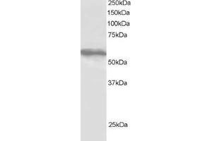 Western Blotting (WB) image for anti-Tripartite Motif-containing 4 (TRIM4) (C-Term) antibody (ABIN2466398) (TRIM4 抗体  (C-Term))