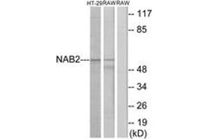 Western blot analysis of extracts from HT-29/RAW264. (NAB2 抗体  (AA 261-310))