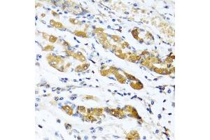 Immunohistochemistry of paraffin-embedded human stomach using OGN antibody (ABIN6131952, ABIN6145008, ABIN6145009 and ABIN6222384) at dilution of 1:100 (40x lens). (OGN 抗体  (AA 20-298))