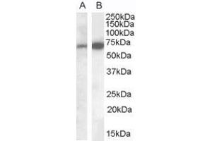 Western Blotting (WB) image for anti-Cell Adhesion Molecule 4 (CADM4) (C-Term) antibody (ABIN2465490) (Cell Adhesion Molecule 4 抗体  (C-Term))