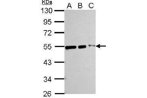 Western Blotting (WB) image for anti-Tubulin, beta (TUBB) antibody (ABIN2854998)
