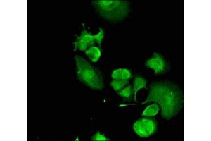 Immunofluorescent analysis of MCF-7 cells using ABIN7152544 at dilution of 1:100 and Alexa Fluor 488-congugated AffiniPure Goat Anti-Rabbit IgG(H+L) (FANCC 抗体  (AA 1-210))