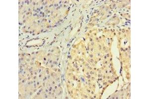 Immunohistochemistry of paraffin-embedded human pancreatic tissue using ABIN7174304 at dilution of 1:100 (USP3 抗体  (C-Term))