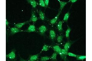 Immunofluorescence (IF) image for anti-Tumor Protein P53 (TP53) (C-Term) antibody (ABIN870299) (p53 抗体  (C-Term))