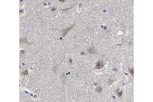 ABIN6269111 at 1/200 staining human brain tissue sections by IHC-P. (HNRNPC 抗体  (C-Term))