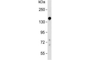 Western blot testing of human liver lysate with Lubricin antibody at 1:500. (Proteoglycan 4 抗体  (AA 176-210))