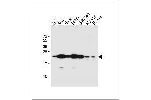All lanes : Anti-RAB1B Antibody (C-term) at 1:1000 dilution Lane 1: 293 whole cell lysate Lane 2: A431 whole cell lysate Lane 3: Hela whole cell lysate Lane 4: T47D whole cell lysate Lane 5: U-87MG whole cell lysate Lane 6: Mouse liver lysate Lane 7: Rat liver lysate Lysates/proteins at 20 μg per lane. (RAB1B 抗体  (C-Term))