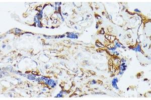 Immunohistochemistry (Paraffin-embedded Sections) (IHC (p)) image for anti-Cytochrome C Oxidase Assembly Homolog 15 (COX15) antibody (ABIN7258036)