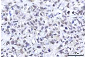 IHC analysis of RBM22 using anti-RBM22 antibody (ABIN7600268).