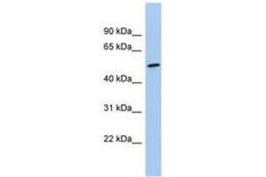 Image no. 1 for anti-Naked Cuticle Homolog 1 (NKD1) (C-Term) antibody (ABIN6744706) (NKD1 抗体  (C-Term))