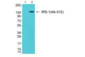 Western blot analysis of extracts from JK cells (Lane 2), using IRS-1 (Ab-312) antiobdy.