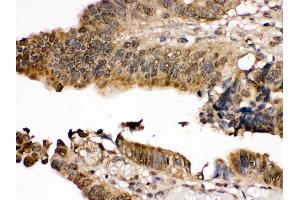 Immunohistochemistry (IHC) image for anti-Mitogen-Activated Protein Kinase Kinase 7 (MAP2K7) (AA 2-40), (N-Term) antibody (ABIN3043875)