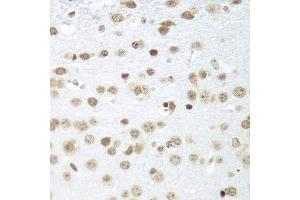 Immunohistochemistry of paraffin-embedded mouse brain using SAP18 antibody at dilution of 1:100 (40x lens). (SAP18 抗体)